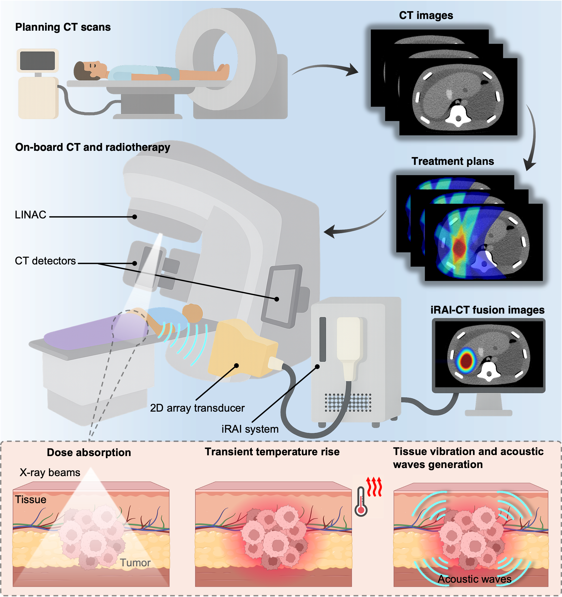 Schematic and operating principle of iRAI during radiotherapy